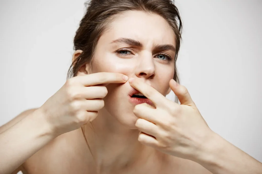 چگونه از شر جوش‌های سر سیاه خلاص شویم؟
